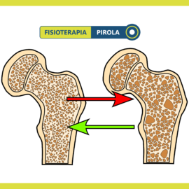 Offerta di Ottobre! Il trattamento dell’osteoporosi con Limfa Therapy
